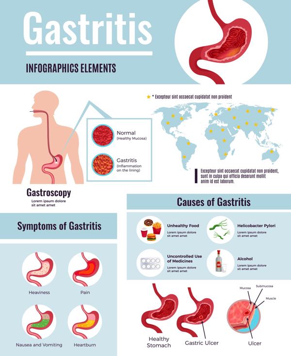 Gastritis Causes Symptoms Diagnosis Treatment Scam Or Legit 