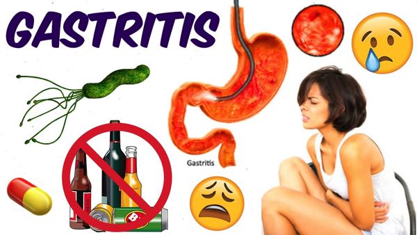 gastritis features