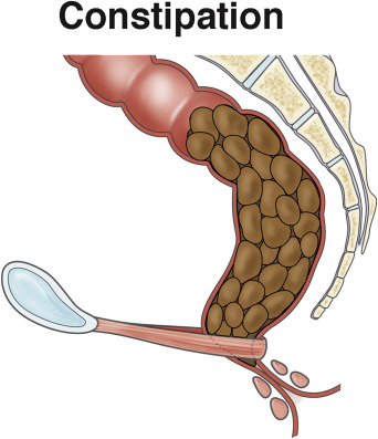 intestines