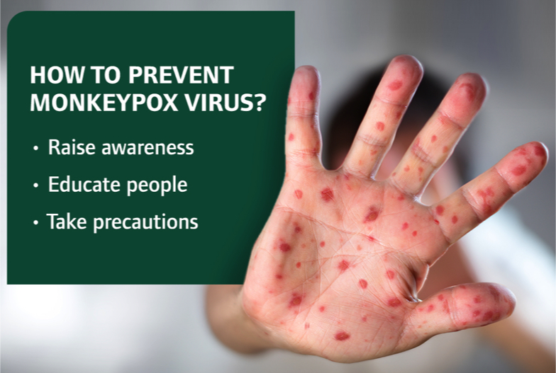 prevent monkeypox